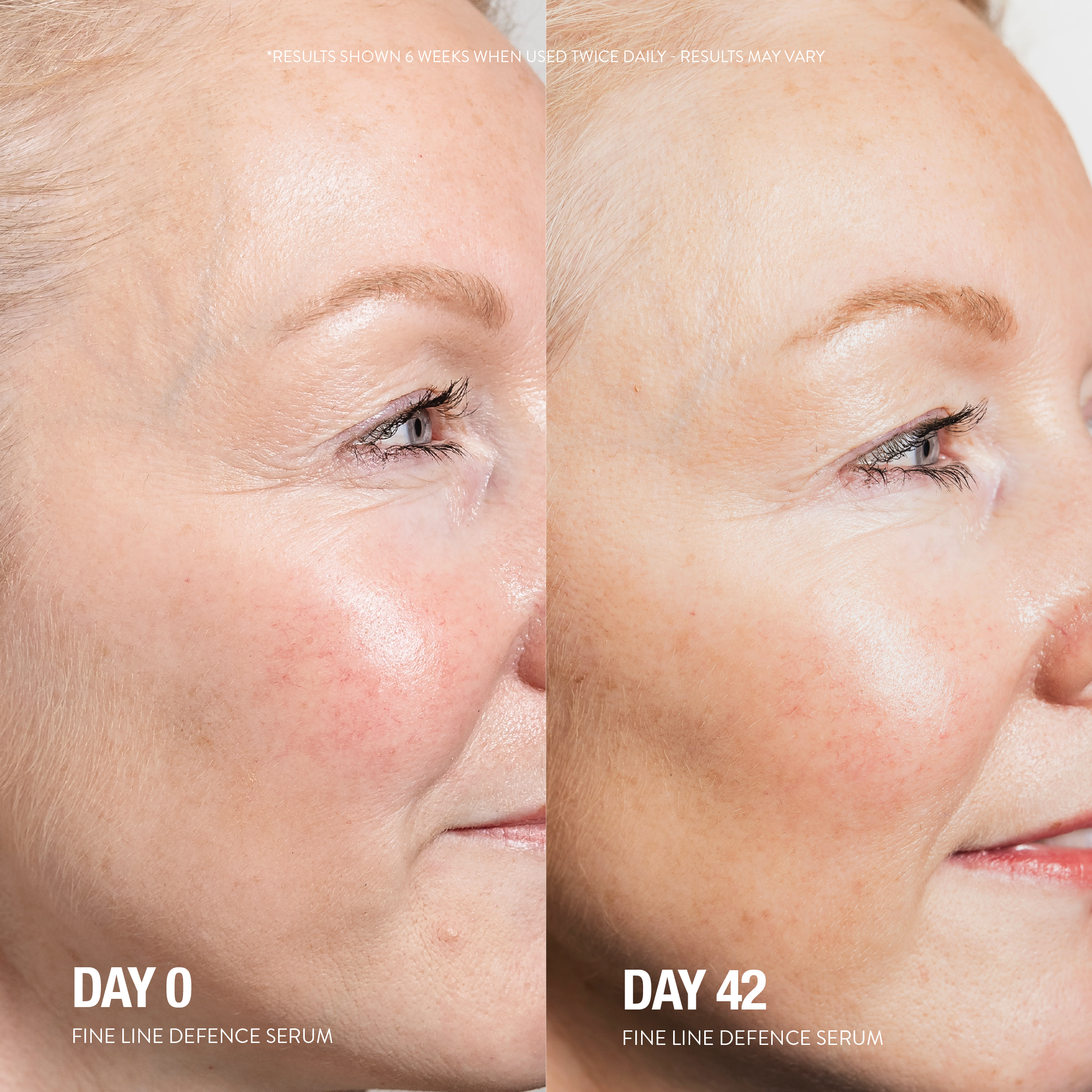 Fine Line Defence Serum